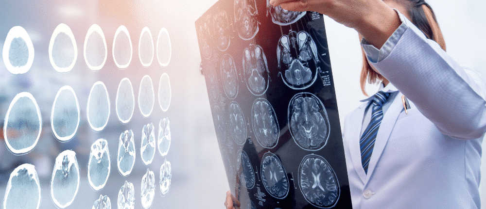 IM-Webinar-Headers-POST-CONCUSSION